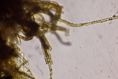 Piloderma