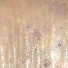 Mesomphix vulgatus