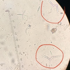 Tricladium angulatum