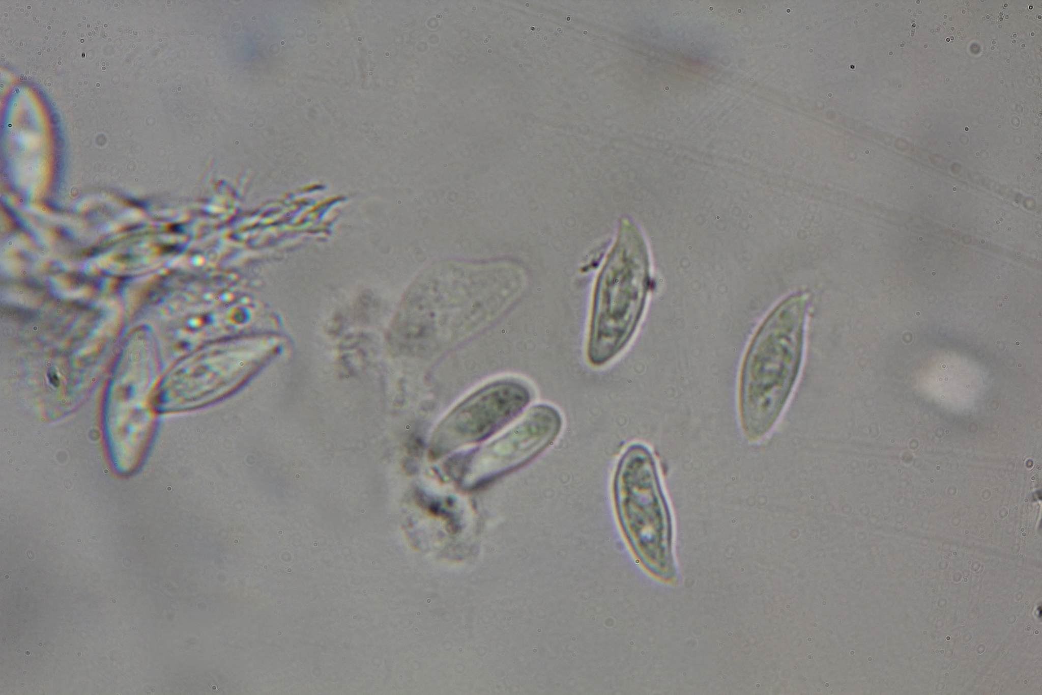 Lepiota magnispora image