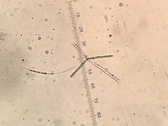 Lemonniera pseudofloscula