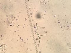 Tricladium angulatum