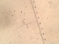 Tricladium angulatum