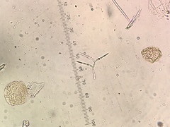 Tricladium angulatum