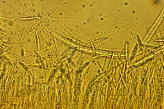Dicephalospora rufocornea