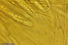Dicephalospora rufocornea