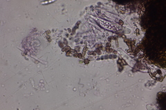 Colletotrichum agaves
