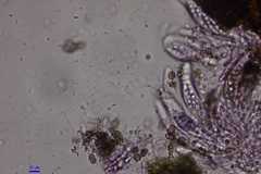 Colletotrichum agaves