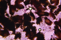Colletotrichum agaves