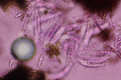 Colletotrichum agaves