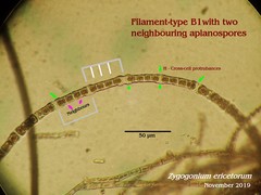 Zygogonium ericetorum