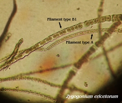 Zygogonium ericetorum