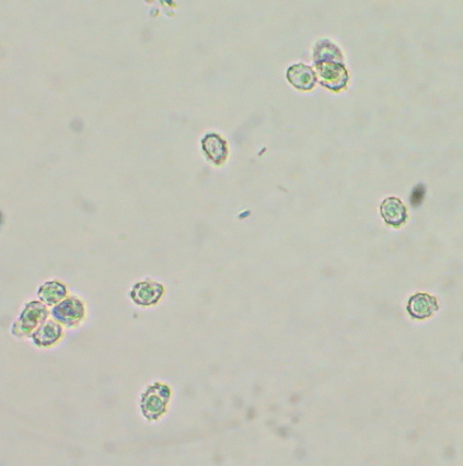Asproinocybe image