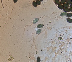 Podospora setosa