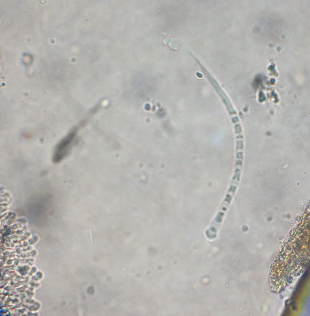 Ophiocordyceps gracilioides image