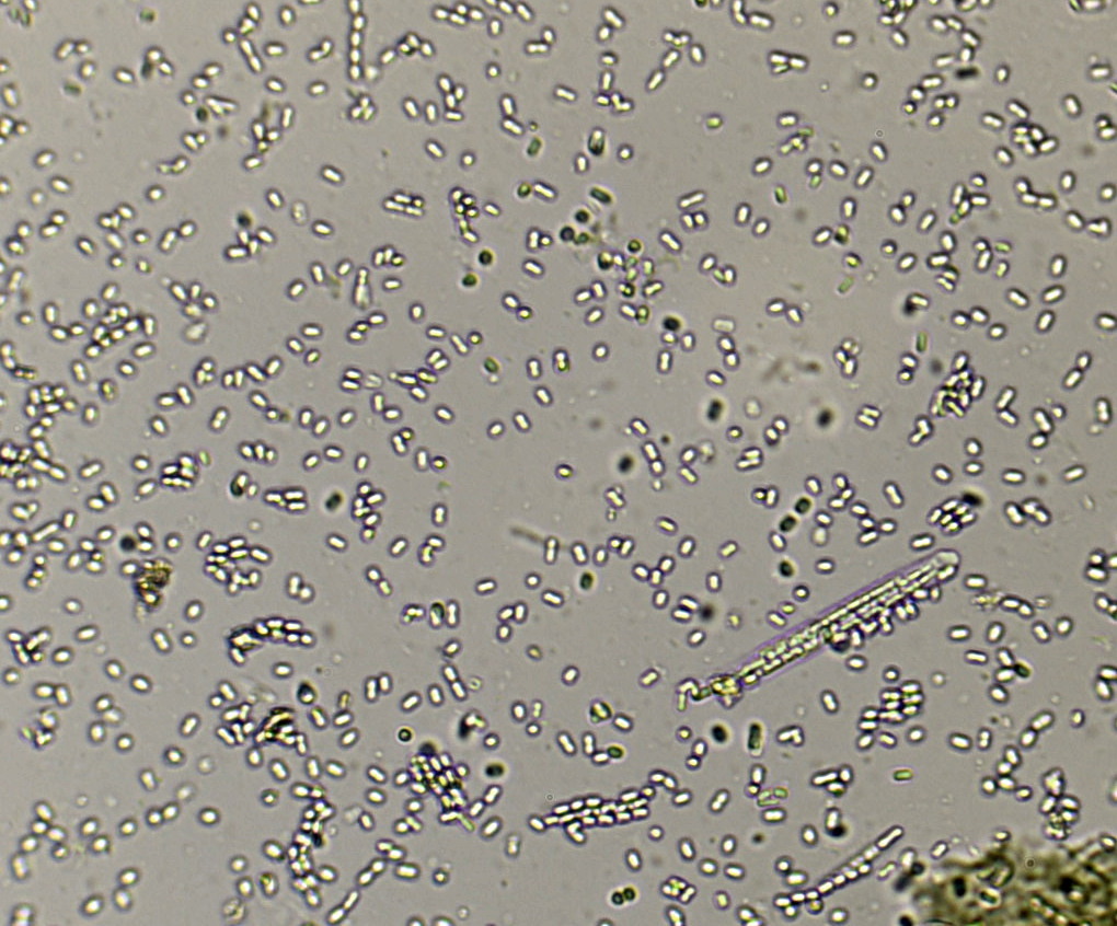 Tolypocladium ophioglossoides image