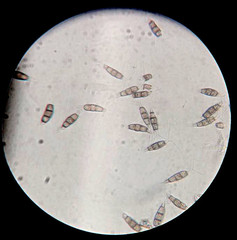Pestalotiopsis microspora
