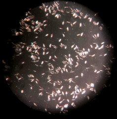 Pestalotiopsis microspora