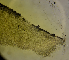 Lepiota trichroma