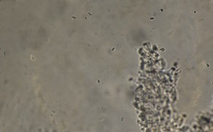 Lepiota trichroma