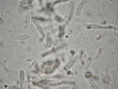 Tricholosporum tropicale