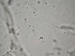 Tricholosporum tropicale