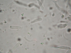 Tricholosporum tropicale