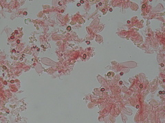 Micropsalliota