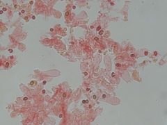 Micropsalliota
