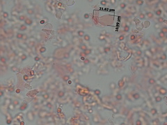 Micropsalliota