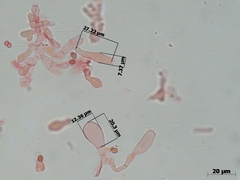 Micropsalliota