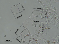 Micropsalliota