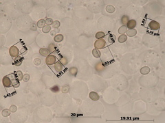 Micropsalliota