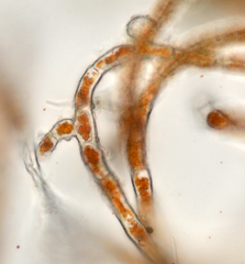 Trentepohlia abietina