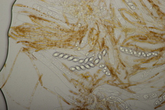 Neottiella rutilans