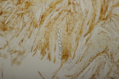 Neottiella rutilans