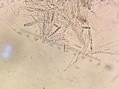 Lophiostoma