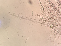 Lophiostoma