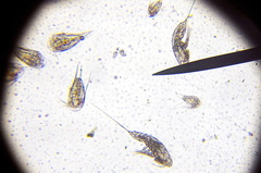 Microsetella norvegica