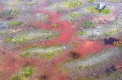 Microsetella norvegica