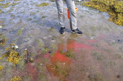 Microsetella norvegica