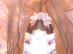 Mesopsocus