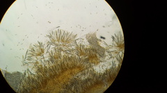 Dicephalospora rufocornea