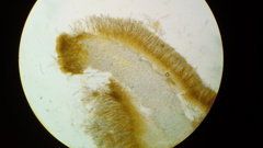 Dicephalospora rufocornea