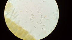 Dicephalospora rufocornea