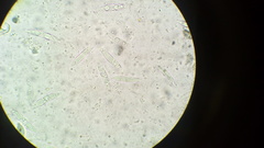 Dicephalospora rufocornea