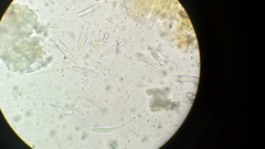 Dicephalospora rufocornea