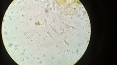 Dicephalospora rufocornea