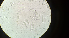 Dicephalospora rufocornea