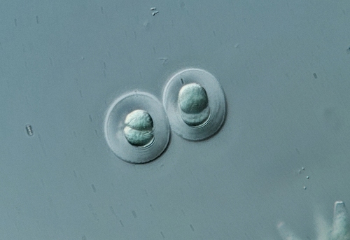 Limnococcus limneticus observed 2025-09-29
